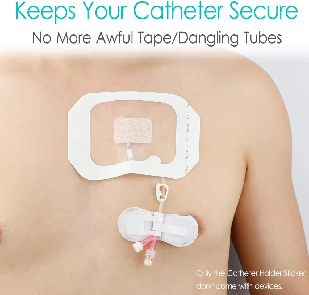 Low Profile Feeding Tube Holder Peg G-Tube Stabilizer Picc Line Peritoneal Dialysis Accessories Catheter Stabilization Device Bandages for Stomach Kids Baby (Pack of 10)